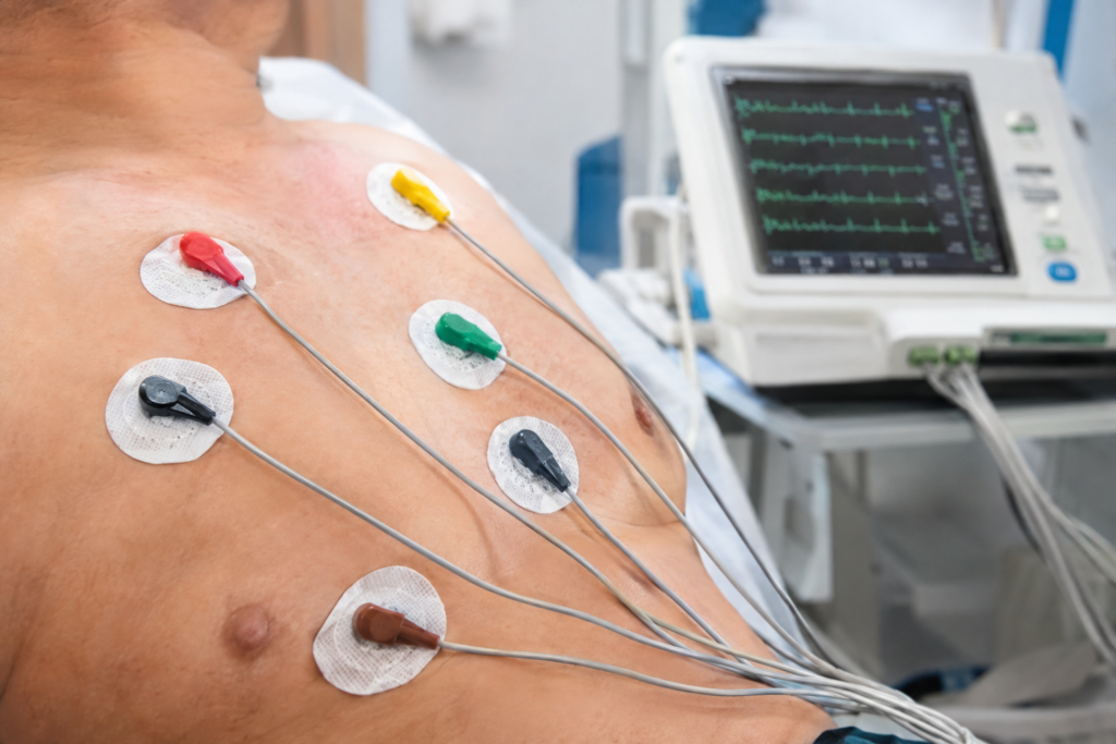 ECG Electrodes: How Gel, Sensor, and Backing Affect Signal Quality
